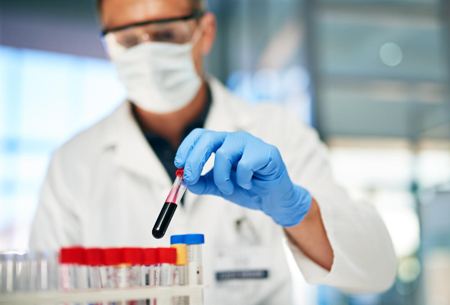 Dia Mundial do Rim: Clínica de Hemodiálise fará exames gratuitos de creatina na quinta-feira